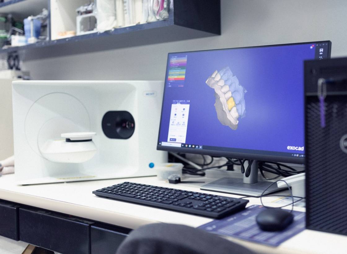 歯科技工CADソフト